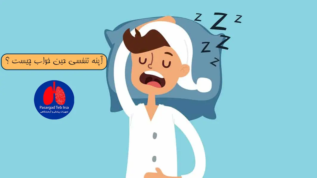 آپنه خواب چیست